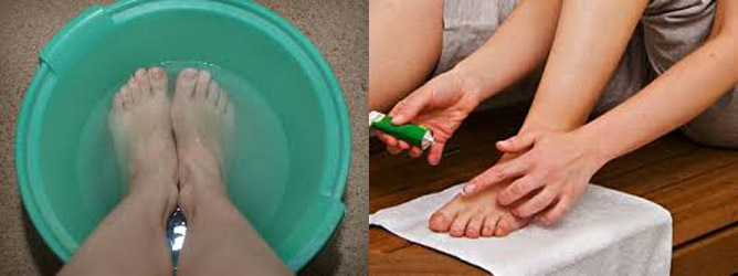 Грибок ногтей на ногах: как организовать лечение в домашних условиях современными средствами